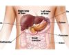 Penyakit Liver –  Pengertian, Penyebab, Ciri/ Gejala, Penyembuhan