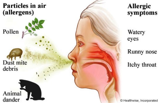 Rhinitis: Gejala, Penyebab, Pengobatan